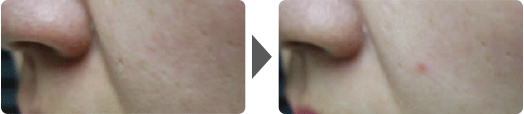 Asterasys_Futera-Dots-PartB-pic2