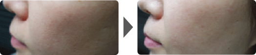 Asterasys_Futera-Dots-PartB-pic3